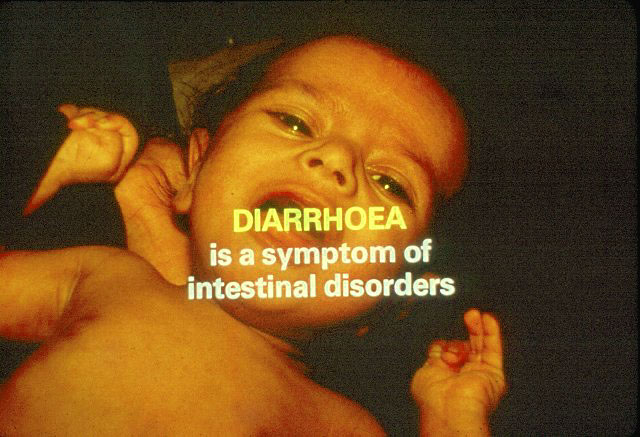 Slide 22 - A Simple Solution to curb the effects of diarrhoea in infants and young children
