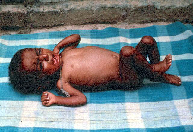 Slide 27 - A Simple Solution to curb the effects of diarrhoea in infants and young children