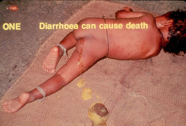 Slide 113 - A Simple Solution to curb the effects of diarrhoea in infants and young children