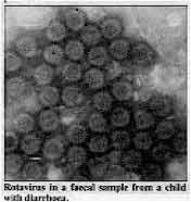 Rotavirus in a faecal sample from a child with diarrhoea.