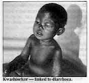 Kwashiokor - linked to diarrhoea.