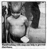 Handwasbing with soap can help to prevent diarrhoea.