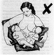 Incorrect position for feeding twins