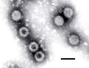 Rotavirus is the most common cause of severe gastroenteritis in children worldwide.